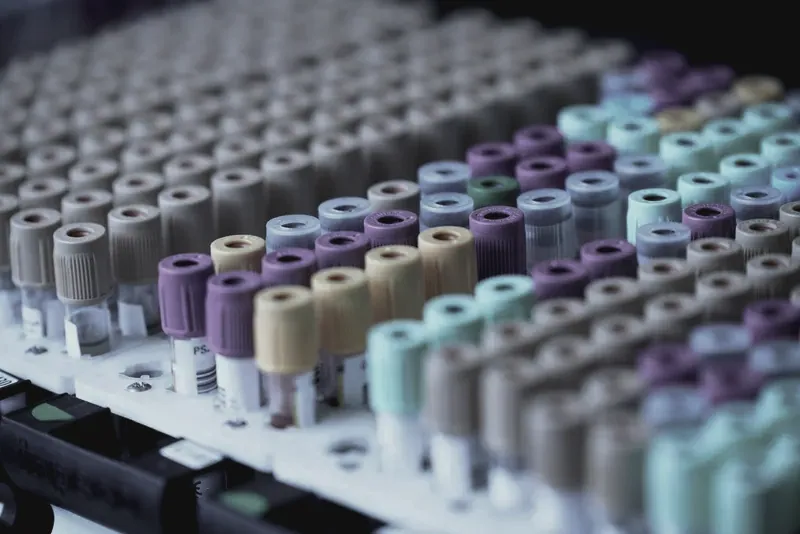 Rows of blood collection tubes with colored caps in a laboratory rack